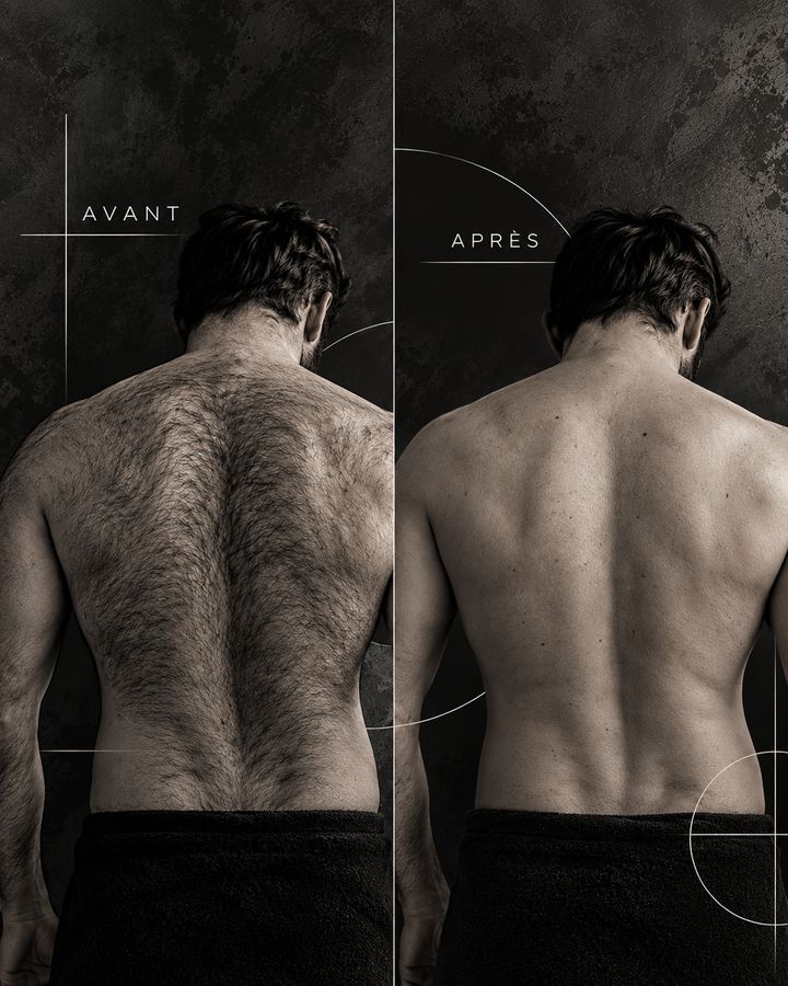 Le protocole d'épilation laser homme chez Hôrs Cadre